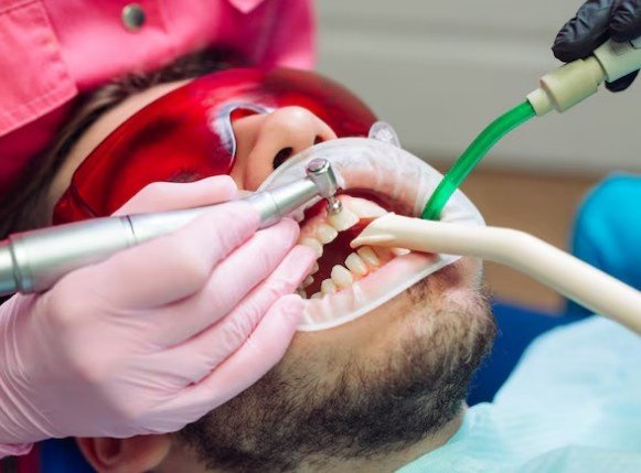 Root Canal Treatment in Sector 10, Vasundhara