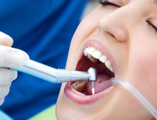 Best Dentist for Scaling in Sector 14, Vasundhara